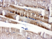 IHC staining of FFPE mouse skeletal muscle with FABP3 antibody. HIER: boil tissue sections in pH6, 10mM citrate buffer, for 20 min and allow to cool before testing.