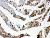 IHC-P: FABP3 antibody testing of rat heart tissue