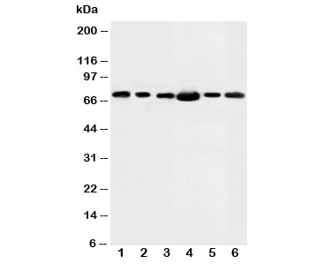 Western blot testing of FAF1 antibody and Lane 1: rat testis; 2: MM453; 3: MM231; 4: HeLa; 5: SMMC-7721; 6: SW620