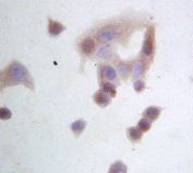 ICC: GRP94 antibody testing of HeLa cell