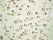 IHC-P: GRP94 antibody testing of rat brain tissue. HIER: steamed with pH6 citrate buffer.