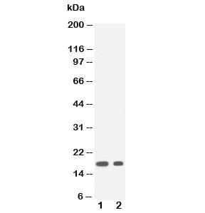 Western blot testing of IL1 beta antibody and Lane 1: recombinant human protein 20ng; 2: 10ng