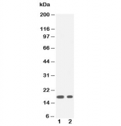 Western blot testing of IL1 beta antibody and Lane 1:  recombinant human partial protein 20ng;  2: 10ng