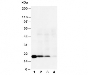 Western blot testing of IL-18 antibody and Lane 1:  Recombinant human IL-18 protein 10ng;  2: 5ng;  3: 2.5ng;  4: Raji; Predicted molecular weight: 17~24 kDa