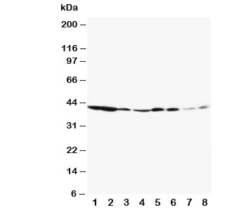 Western blot testing of ERK1 antibody and Lane 1: rat spleen; 2: rat thymus; 3: rat skeletal muscle; 4: rat kidney; 5: HeLa; 6: Jurkat; 7: Raji; 8: COLO320~
