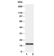 Western blot testing of SOD1 antibody and Lane 1:  COLO320;  2: SMMC-7721 cell lysate. Predicted molecular weight: ~16 kDa.