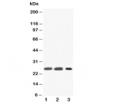 Western blot testing of SFTPA1 antibody and Lane 1:  rat lung;  2: rat lung (different lot);  3: human Raji lysate. Predicted molecular weight: ~26 kDa but may be observed at higher molecular weights due to glycosylation.