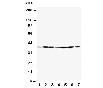 Western blot testing of Annexin A2 antibody and Lane 1: rat testis; 2: rat lung; 3: rat ovary; 4: MCF-7; 5: SMMC-7721; 6: A549; 7: Jurkat~