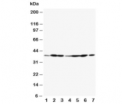 Western blot testing of Annexin A2 antibody and Lane 1:  rat testis;  2: rat lung;  3: rat ovary;  4: MCF-7;  5: SMMC-7721;  6: A549;  7: Jurkat