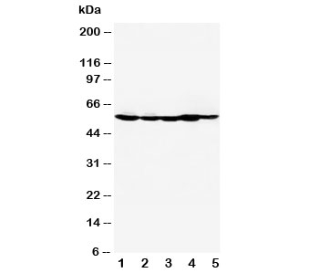 Western blot testing of HDAC2 antibody and Lane 1: MM453; 2: MCF-7; 3: HeLa; 4: SMMC-7721; 5: COLO320. Predicted molecular weight: 55-60 kDa.~