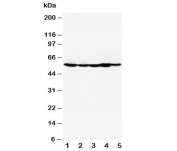 Western blot testing of HDAC2 antibody and Lane 1:  MM453;  2: MCF-7;  3: HeLa;  4: SMMC-7721;  5: COLO320. Predicted molecular weight: 55-60 kDa.