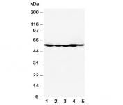 Western blot testing of HDAC2 antibody and Lane 1:  MM453;  2: MCF-7;  3: HeLa;  4: SMMC-7721;  5: COLO320. Predicted molecular weight: 55-60 kDa.