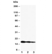 Western blot testing of IL1 beta antibody and Lane 1:  Recombinant mouse IL1b partial protein 10ng;  2: 5ng;  3: 2.5ng