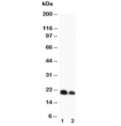 Western blot testing of IL-6 antibody and recombinant protein (1) 10ng, (2) 5ng