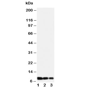 Western blot testing of IL-8 antibody and Lane 1: recombinant human protein 10ng; 2: 5ng; 3: 2.5ng~