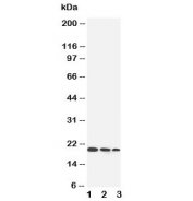 Western blot testing of IL-10 antibody and Lane 1:  Recombinant human IL-10 protein 10ng;  2: 5ng;  3: 2.5ng