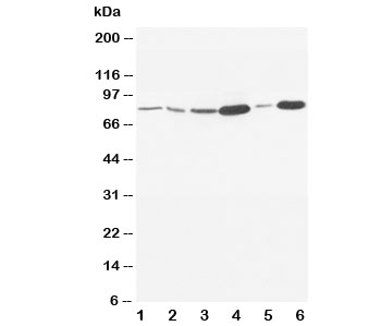 Western blot testing of MMP9 antibody and Lane 1: rat Embryo; 2: MM453; 3: HeLa; 4: SMMC-7721; 5: Jurkat; 6: HT1080. Predicted molecular weight: 82-92 kDa