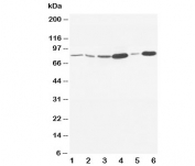 Western blot testing of MMP9 antibody and Lane 1:  rat embryo;  2: MM453;  3: HeLa;  4: SMMC-7721;  5: Jurkat;  6: HT1080. Predicted molecular weight: 92/67-80 kDa (precursor/mature forms).