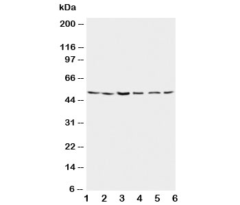 Western blot testing of Presenilin 2 antibody and Lane 1: rat brain; 2: rat brain; 3: MCF-7; 4: HeLa; 5: SMMC-7721; 6: CEM