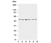 Western blot testing of Presenilin 2 antibody and Lane 1:  rat brain;  2: rat brain;  3: MCF-7; 4: HeLa;  5: SMMC-7721;  6: CEM lysate. Predicted/observed molecular weight: ~50kDa.