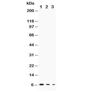 Western blot testing of TGF alpha antibody and Lane 1: recombinant human protein 10ng; 2: 5ng; 3: 2.5ng