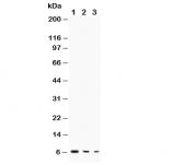 Western blot testing of TGF alpha antibody and Lane 1:  recombinant human protein 10ng;  2: 5ng;  3: 2.5ng