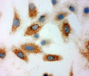 ICC testing of P-Cadherin antibody and A549 cells