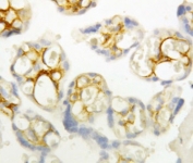 IHC-P: P-Cadherin antibody testing of human placenta tissue