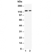 Western blot testing of P-Cadherin antibody and Lane 1: recombinant human protein 10ng;  2: 5ng. Expected molecular weight: ~91 (unmodified), 100~130 kDa (glycosylated).