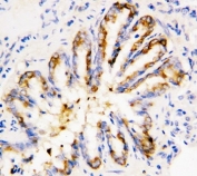 IHC-P: Calpain 1 antibody testing of rat lung tissue