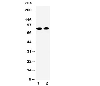 Western blot testing of Calpain 1 antibody and Lane 1: HT1080; 2: COLO320 cell lysate. Predicted/observed size ~82KD