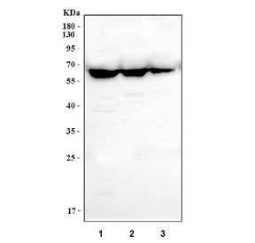 Western blot testing of CD80 antibody and Lane 1: recombinant human protein 10ng; 2: 5ng; 3: 2.5ng