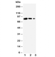 Western blot testing of CD80 antibody and Lane 1:  recombinant human protein 10ng;  2: 5ng;  3: 2.5ng