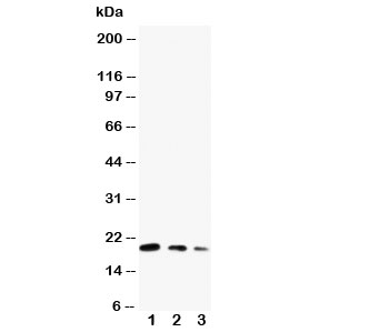 Western blot testing of CDC42 antibody and Lane 1: ecombinant human protein 10ng; 2: 5ng; 3: 2.5ng~