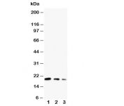 Western blot testing of CDC42 antibody and Lane 1:  ecombinant human protein 10ng;  2: 5ng;  3: 2.5ng