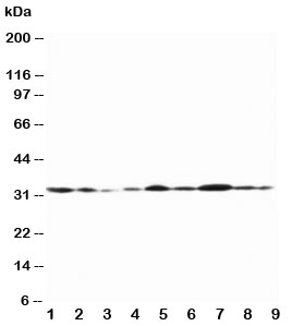 Western blot testing of Connexin 32 antibody and Lane 1: rat heart; 2: rat heart; 3: rat skeletal muscle; 4: rat brain; 5: MCF-7; 6: HeLa; 7: SMMC-7721; 8: Jurkat; 9: COLO320~