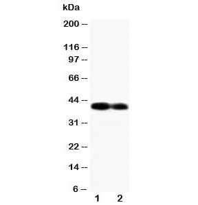 Western blot testing of Connexin 40 antibody and Lane 1: mouse heart; 2: mouse heart tissue lysate~
