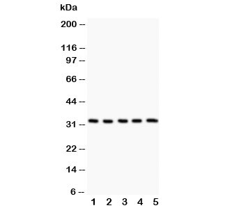 Western blot testing of HSD11B1 antibody and Lane 1: rat liver; 2: rat testis; 3: SMMC-7721; 4: Raji; 5: SW620
