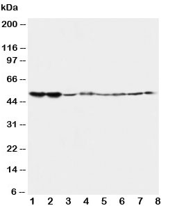 Western blot testing of 5HT2A Receptor antibody and Lane 1: rat brain; 2: rat brain; 3: mouse brain; 4: mouse brain and human samples 5: U87; 6: SMMC-7721; 7: HT1080; 8: COLO320~