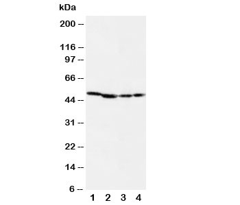 Western blot testing of MEK1 antibody and Lane 1: rat skeletal muscle; 2: rat kidney; 3: (h) CEM; 4: (h) COLO20 cell lysate