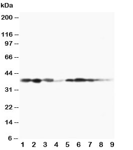 Western blot testing of MEK3 antibody and Lane 1: rat spleen; 2: rat thymus; 3: rat skeletal muscle; 4: rat kidney, and human samples 5: MCF-7; 6: HeLa; 7: Raji; 8: CEM; 9: COLO320 cell lysate~
