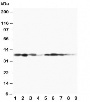 Western blot testing of MEK3 antibody and Lane 1:  rat spleen;  2: rat thymus;  3: rat skeletal muscle;  4: rat kidney, and human samples  5: MCF-7;  6: HeLa;  7: Raji;  8: CEM;  9: COLO320 cell lysate. Expected/observed molecular weight ~39 kDa.