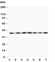 Western blot testing of MEK3 antibody and Lane 1:  rat skeletal muscle;  2: rat kidney;  3: rat spleen;  and human samples 4: HeLa;  5: A549;  6: Jurkat;  7: CEM;  Predicted size: 39KD;  Observed size: 39KD