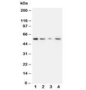 Western blot testing of MMP10 antibody and Lane 1:  recombinant human protein 10ng;  2: 5ng;  3: 2.5ng;  4: HeLa lysate.
