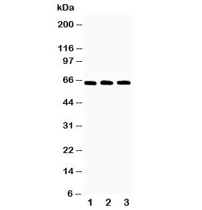 Western blot testing of RANK antibody and Lane 1: recombinant human protein 10ng; 2: 5ng; 3: 2.5ng~