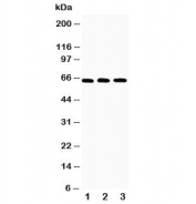 Western blot testing of RANK antibody and Lane 1:  recombinant human protein 10ng;  2: 5ng;  3: 2.5ng