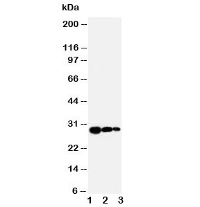 Western blot testing of TIMP1 antibody and Lane 1: recombinant human protein 10ng; 2: 5ng; 3. 2.5ng~
