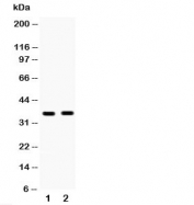 Western blot testing of HSD17B6 antibody and Lane 1:  human placenta;  2: MCF-7;  Predicted/observed molecular weight: ~35kDa.