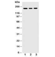Western blot testing of VEGFR antibody and human cell lysates: 1) MCF-7;  2) SGC;  3) MM231. Predicted molecular weight ~150 kDa but may be observed at higher molecular weights due to glycosylation.