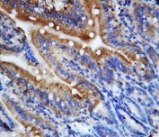 IHC-P: CX3CL1 antibody testing of rat intestine tissue